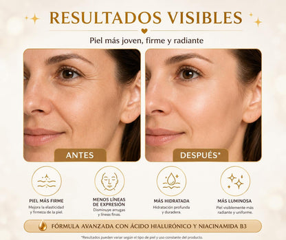 Crema Tipo Botox — Efecto Lifting Inmediato